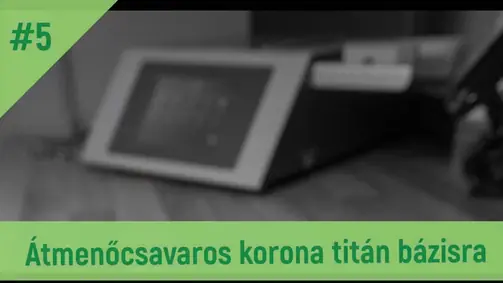 CARES Tutorial #5 Átmenőcsavaros korona