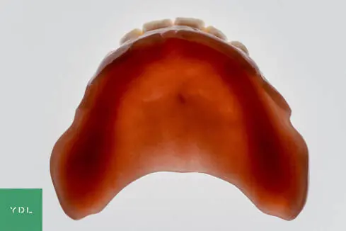 Denture