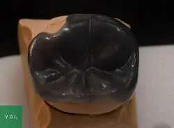 Au onlay wax
