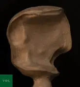 Au onlay cast