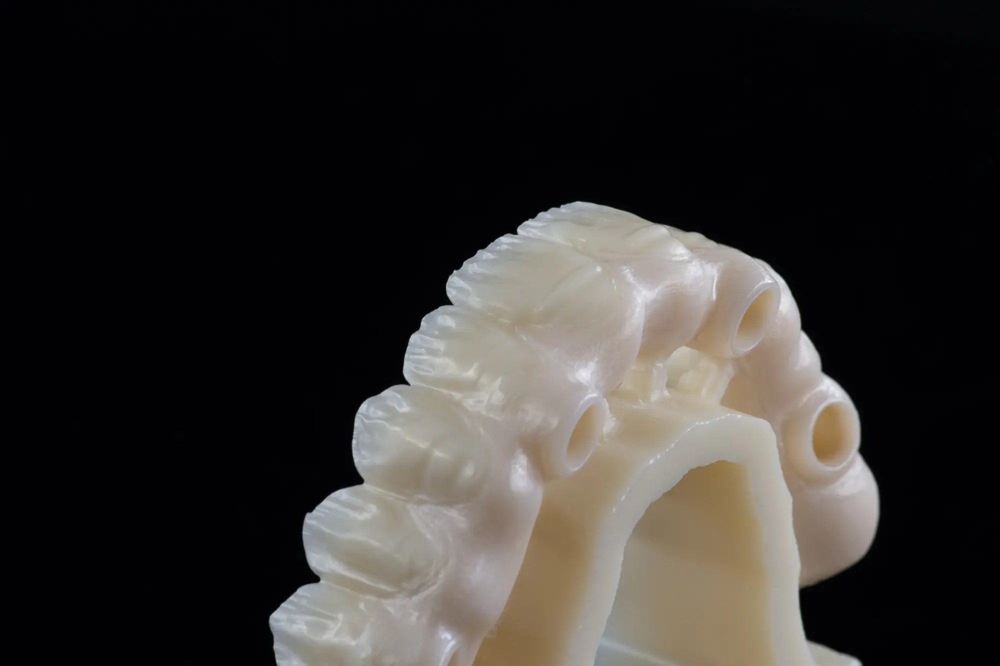 Multilayer cirkónium konstrukció belső felszíne