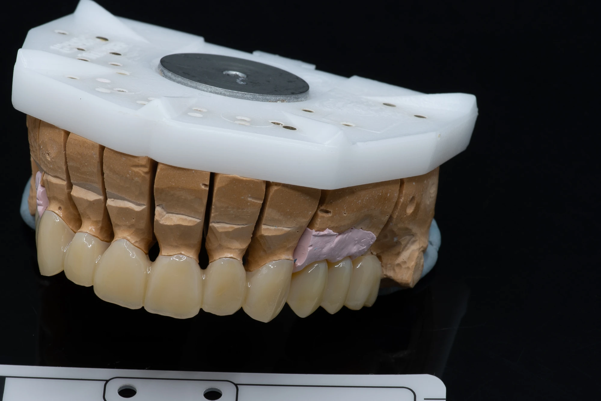 YDL 3D nyomtatott ideiglenes restauráció a mintán