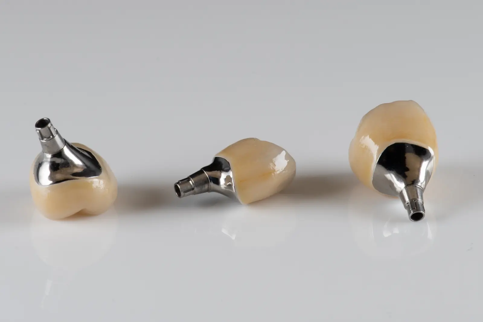 Egyéni implantátum-felépítmény