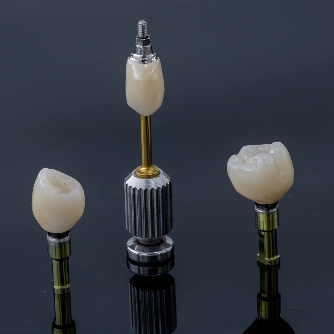 Screw-retained crowns and bridges, image 2