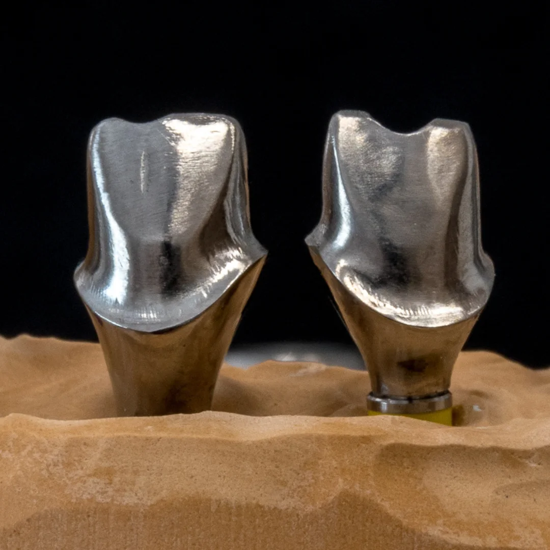 Cement-retained crowns, image 3