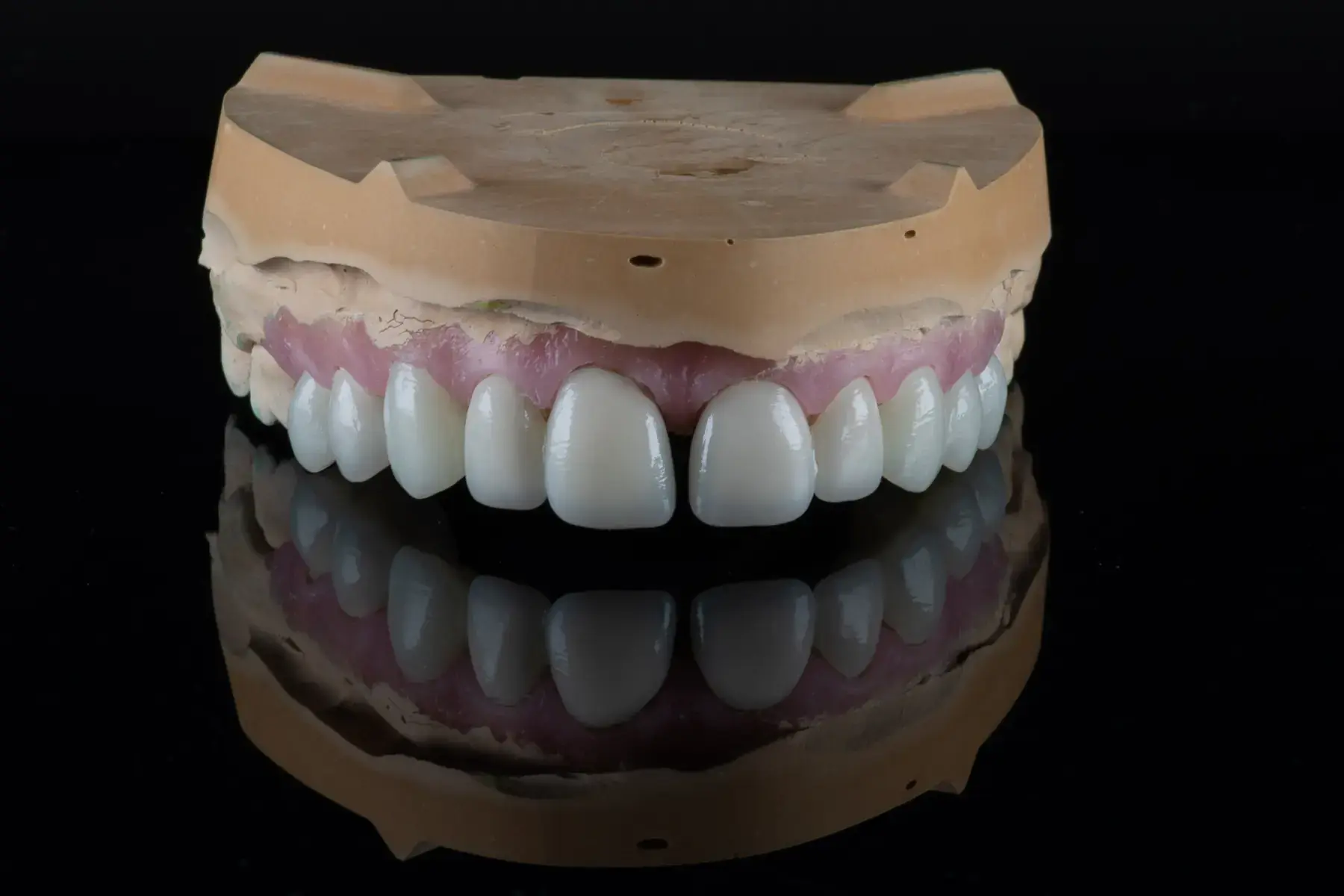 Ideiglenes, 1. kép