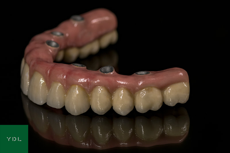 Cad Cam, Screw-retained, Multi Unit, Implant, All on 6