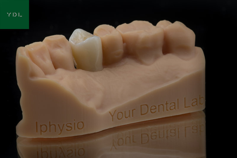 Iphysio crown
Your Dental Lab
