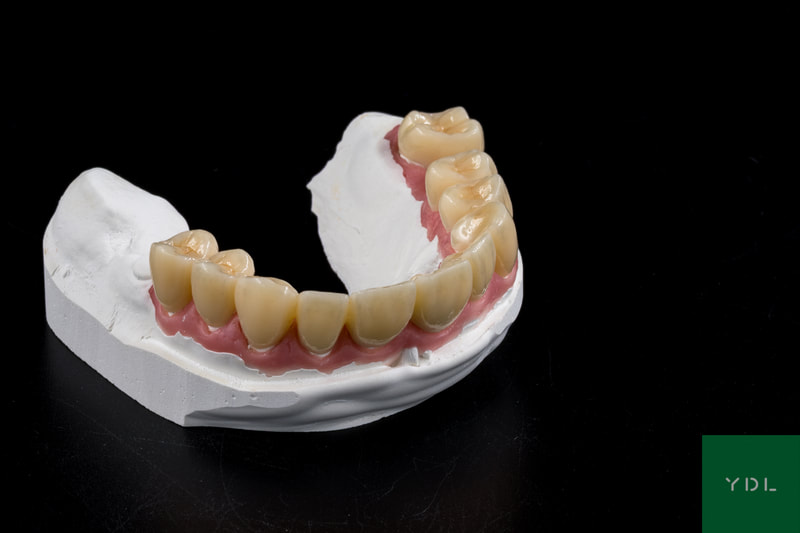 PMMA Telio CAD
Your Dental Lab