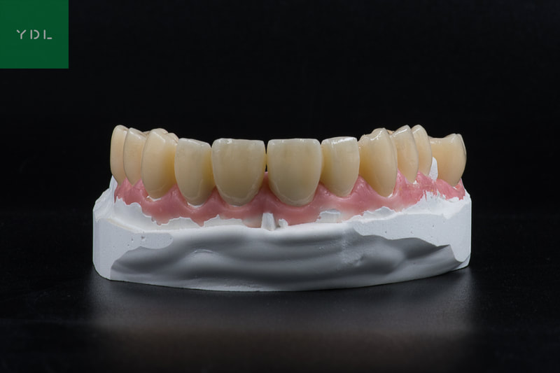 PMMA Telio CAD
Your Dental Lab